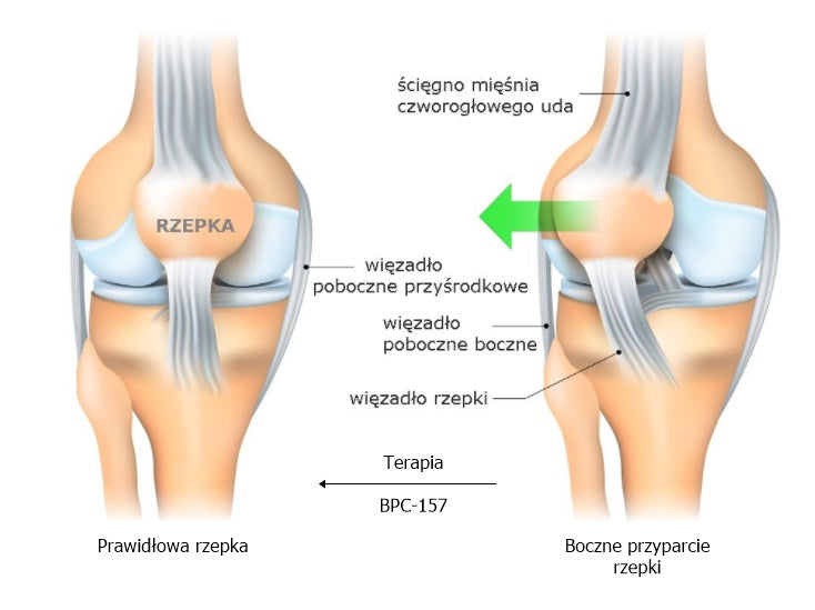 Terapia peptydem BPC-157 we wspieraniu urazów sportowych u sportowców i osób aktywnych fizycznie