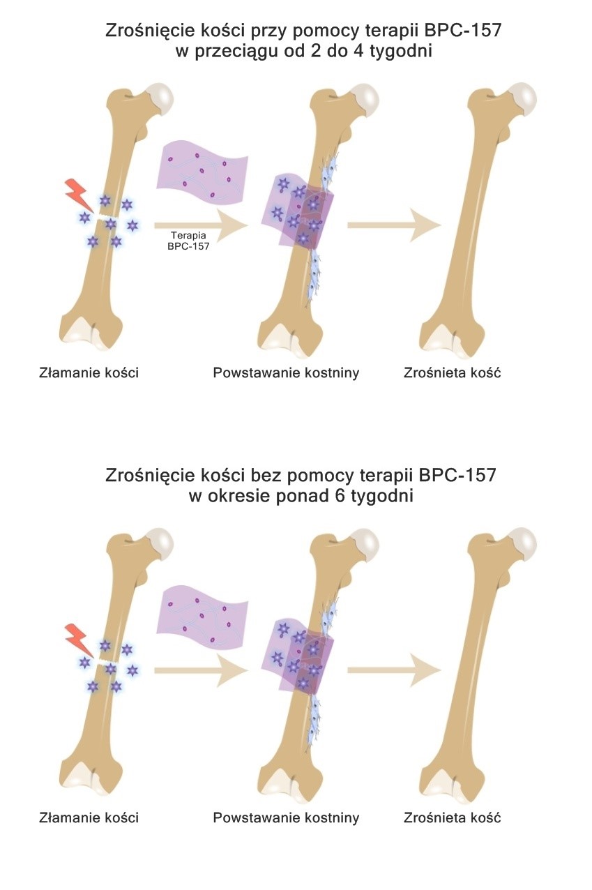 Wpływ BPC-157 na urazy układu kostno-stawowego i mięśniowego 2