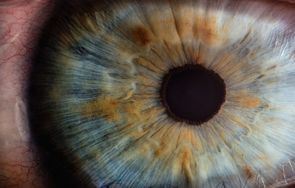 NL-Epithalon w układzie wzrokowym