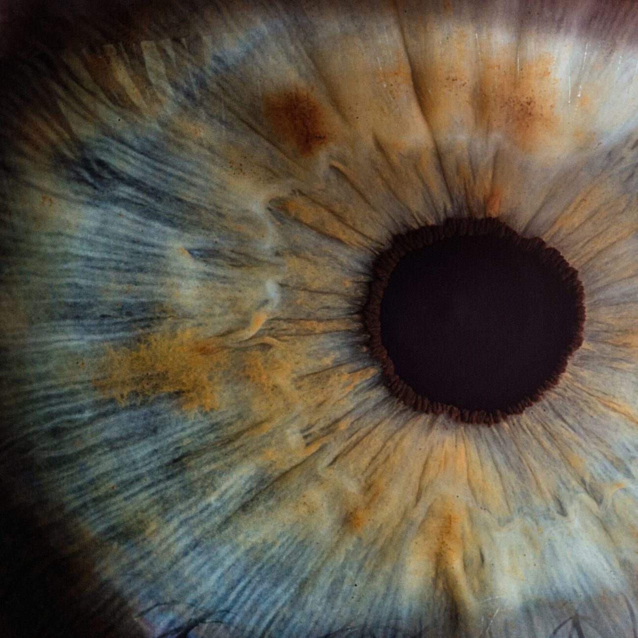 NL-Epithalon w układzie wzrokowym